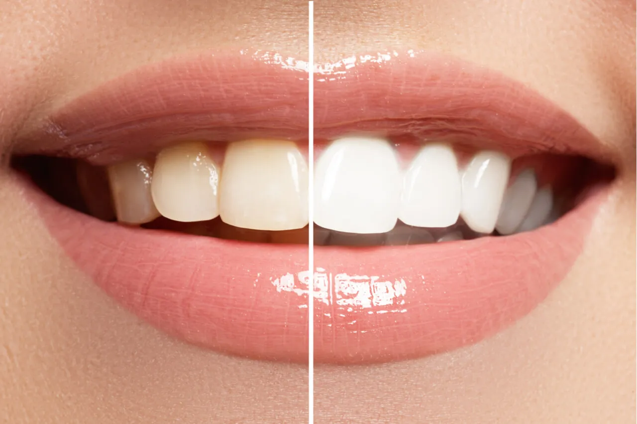 25152 whitening toothpastes