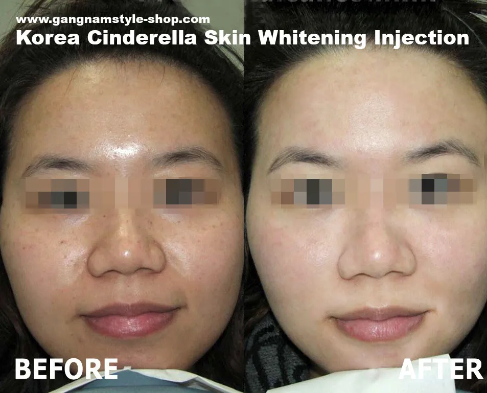 25154 cindella injection ingredients
