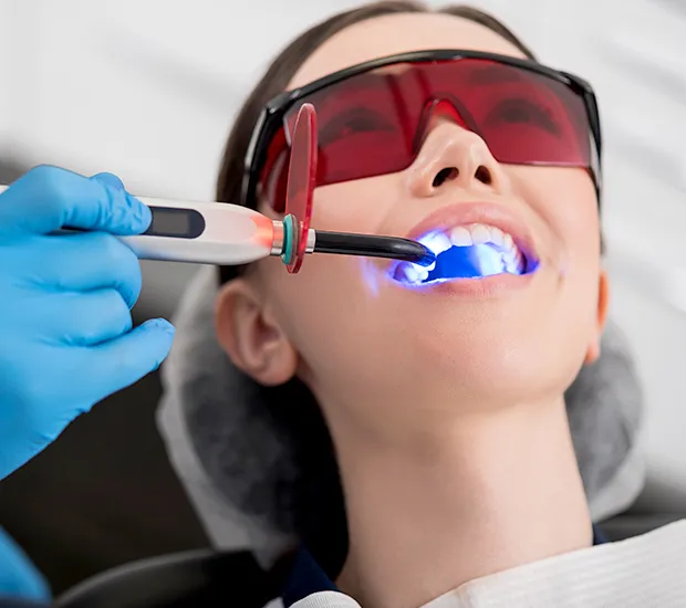25156 teeth whitening marietta ga 3