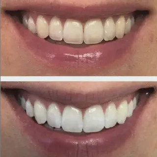 /img/25158-healthy-smile.webp