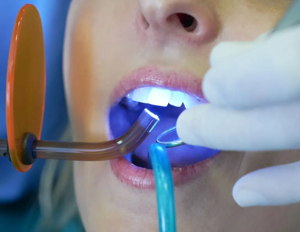 /img/25162-teeth-whitening-avoid-foods-7.webp