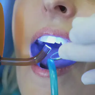 /img/25162-teeth-whitening-avoid-foods-7.webp