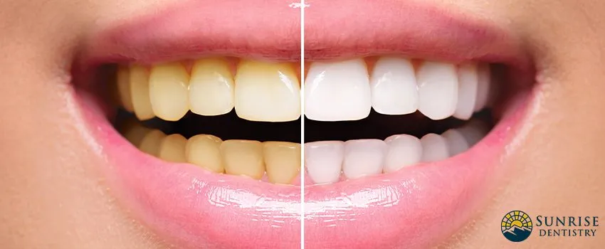 /img/25165-avoiding-staining-foods.webp