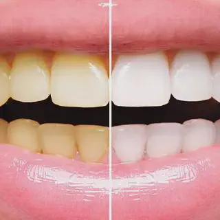 /img/25165-avoiding-staining-foods.webp