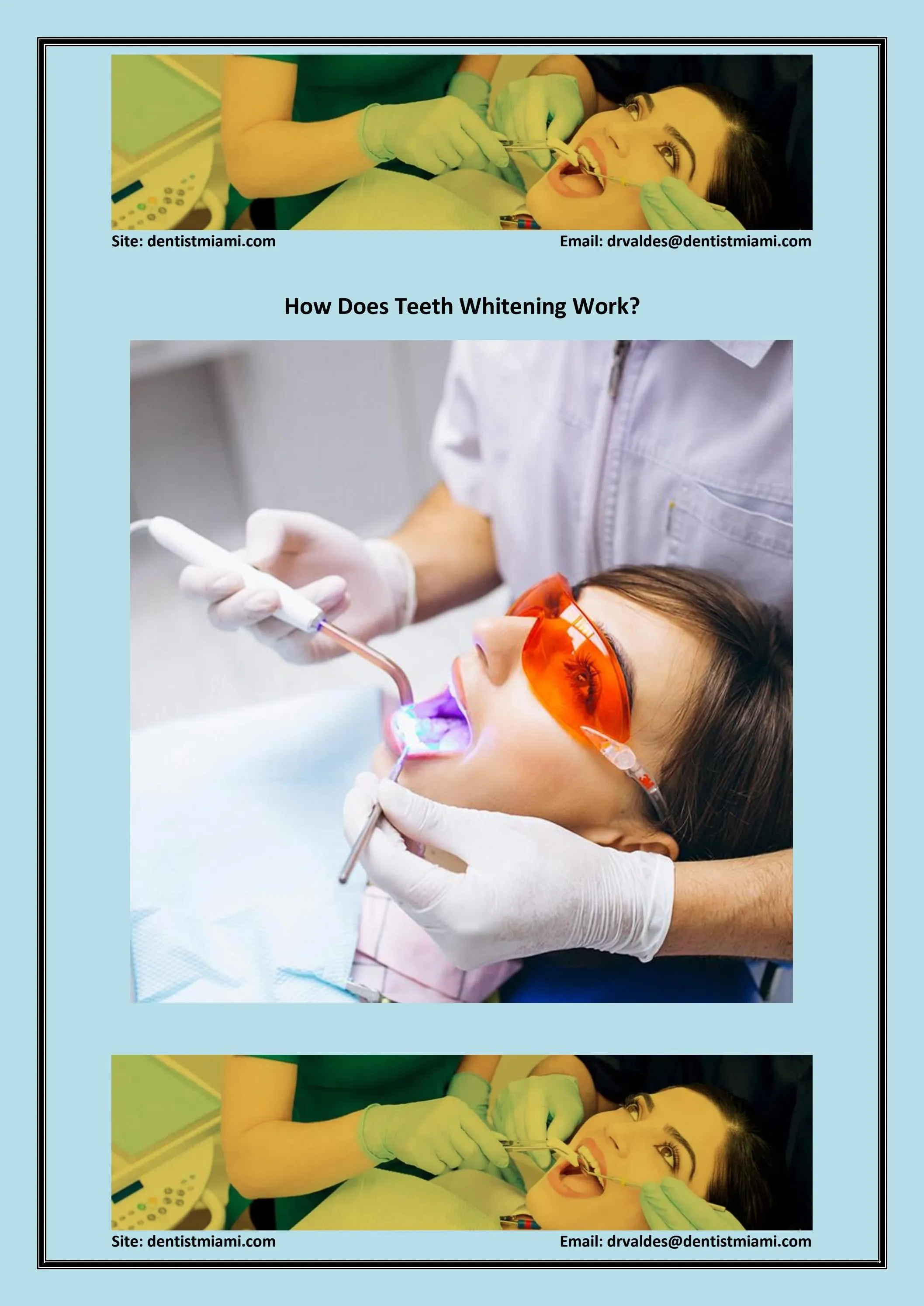 25165 professional vs OTC whitening