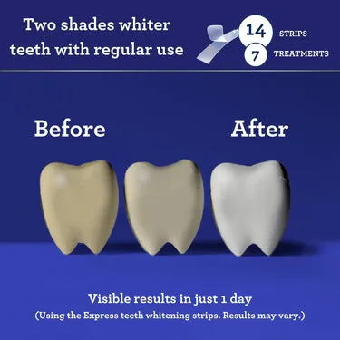 25170 best practices whitening