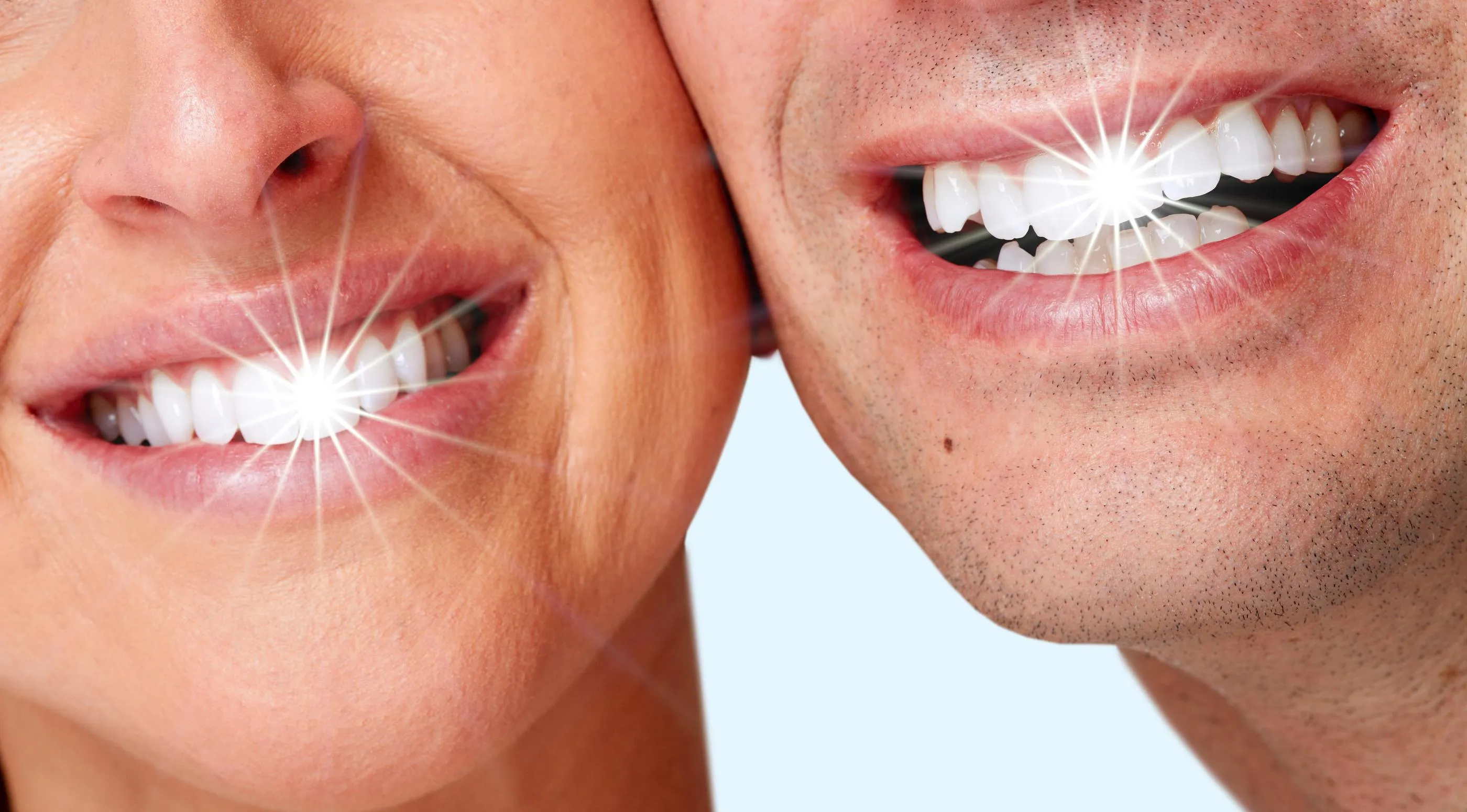 25176 in office teeth whitening