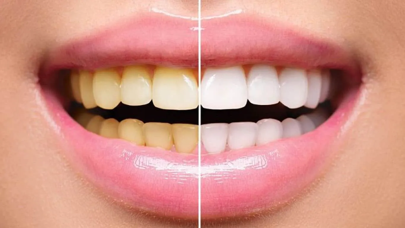 25177 impact of dead tooth