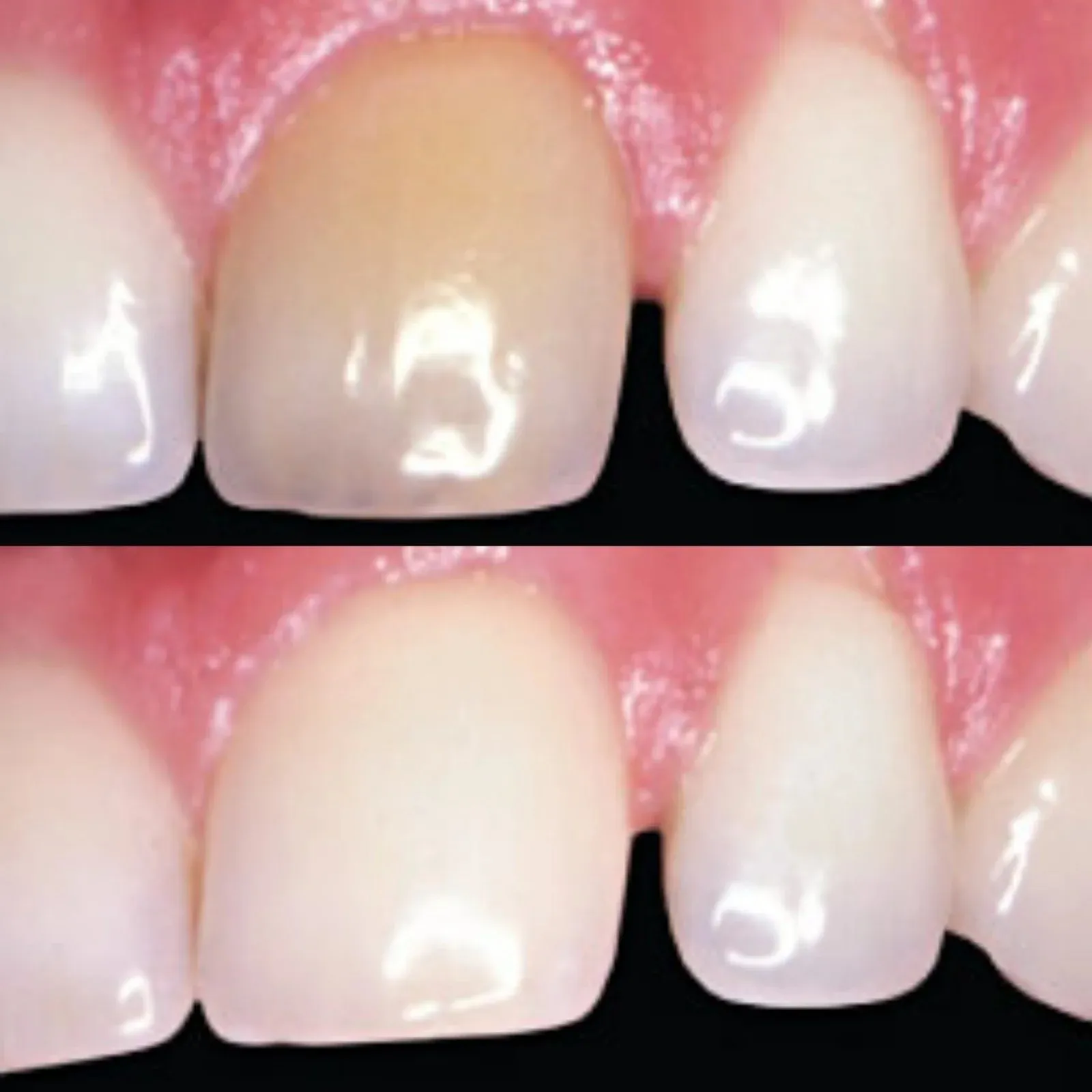 /img/25177-preventing-dead-teeth.webp