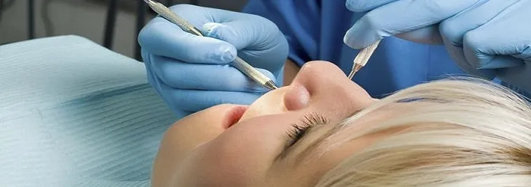 25178 amsterdam teeth whitening cost