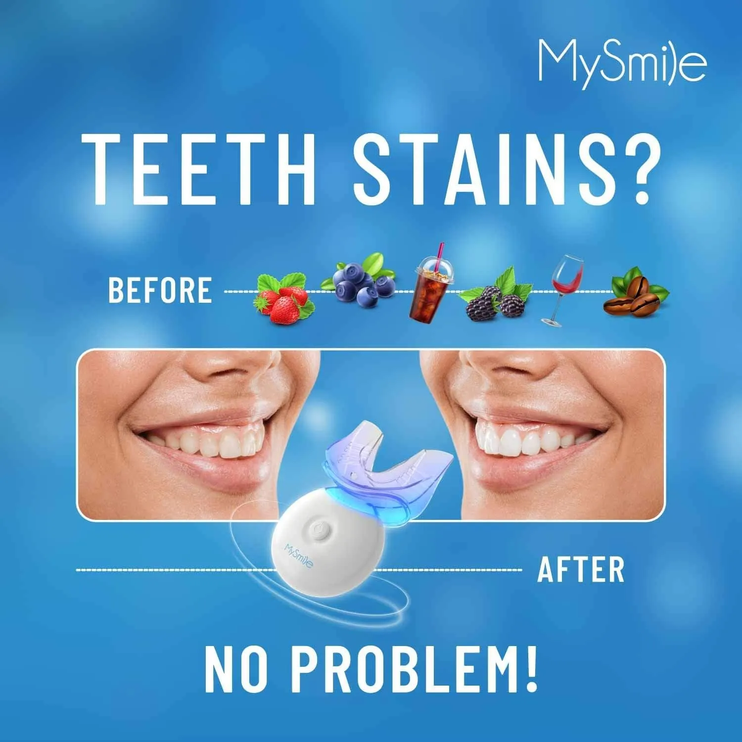 25180 mysmile kit gel application
