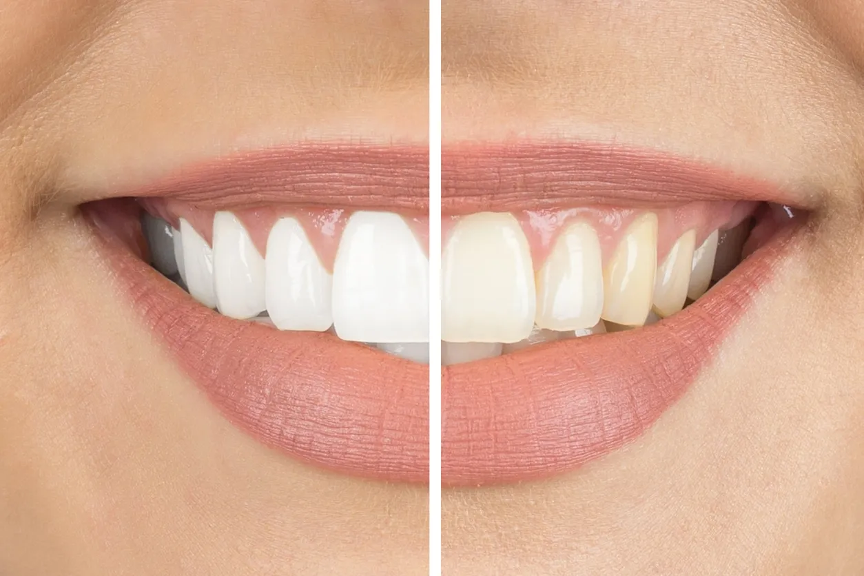 25183 desensitizing toothpaste