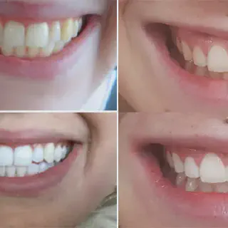 /img/25184-healthy-teeth.webp