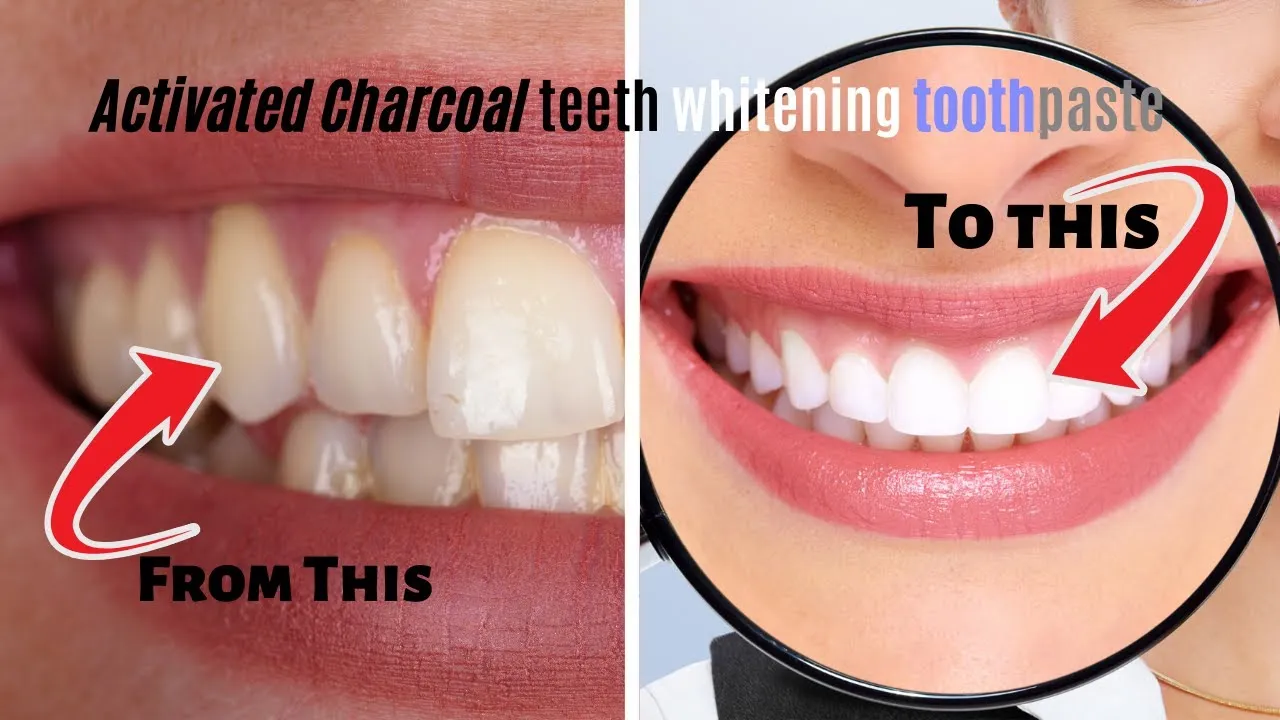 /img/25186-maintain-white-smile.webp