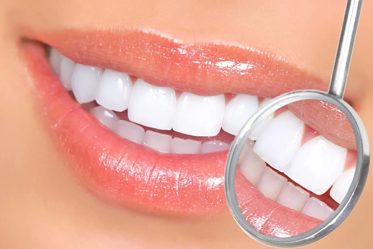 25191 in office teeth whitening