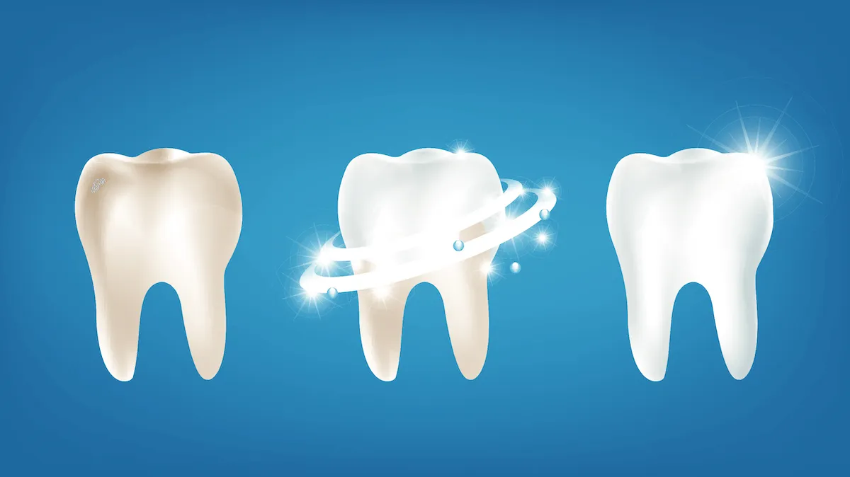 25191 teeth whitening procedure
