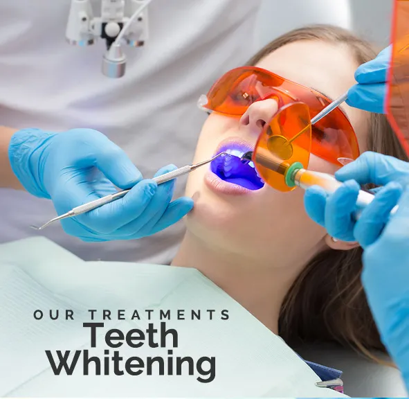 25193 at home whitening