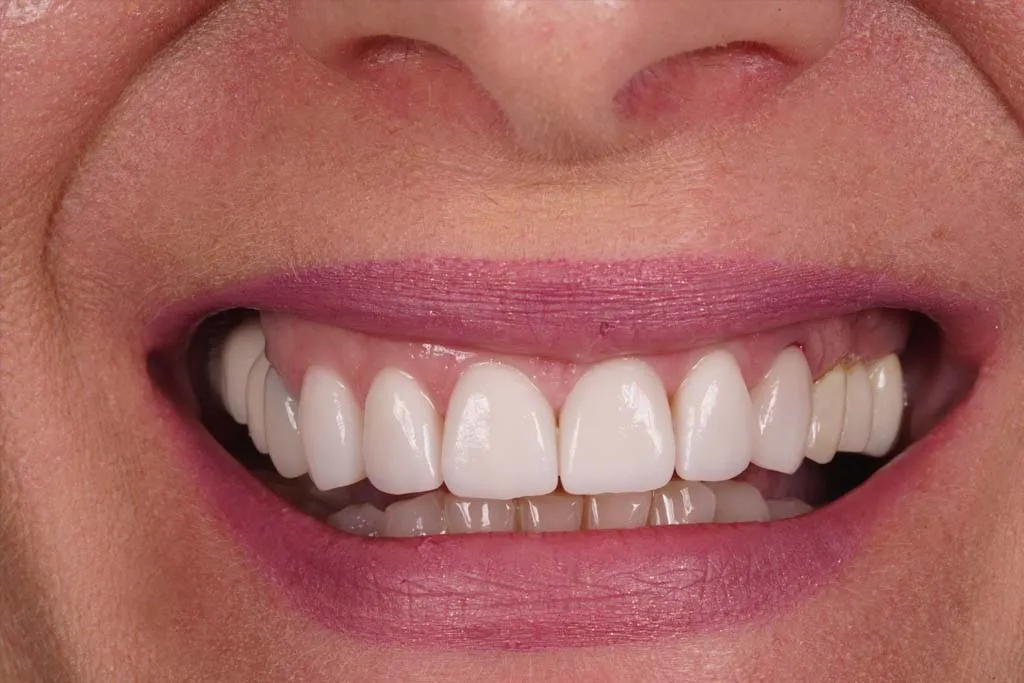 /img/25195-oral-hygiene.webp
