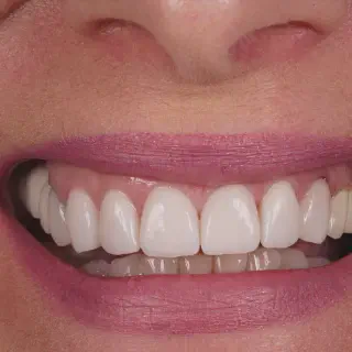 /img/25195-oral-hygiene.webp