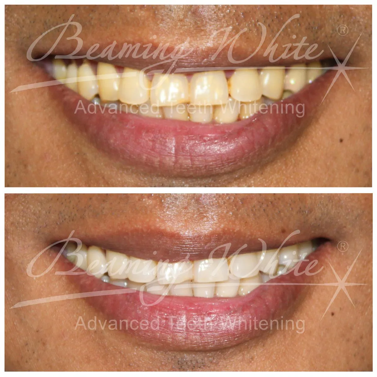 25195 smile makeover