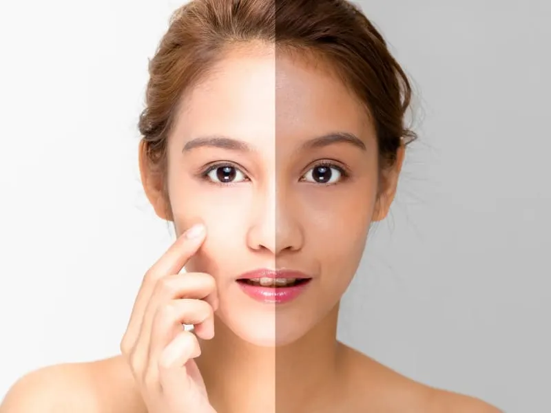 25196 skin whitening delhi image2