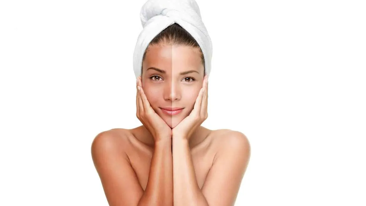25196 skin whitening delhi image4