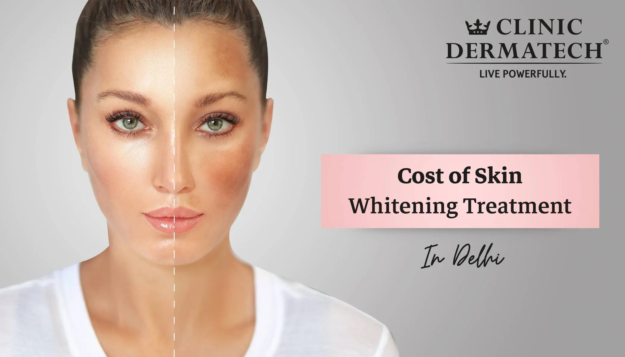 25196 skin whitening delhi image6