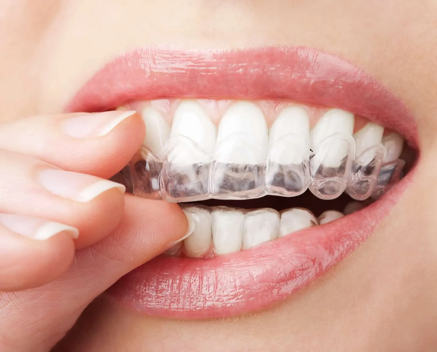 /img/25197-dentist-checkup.webp