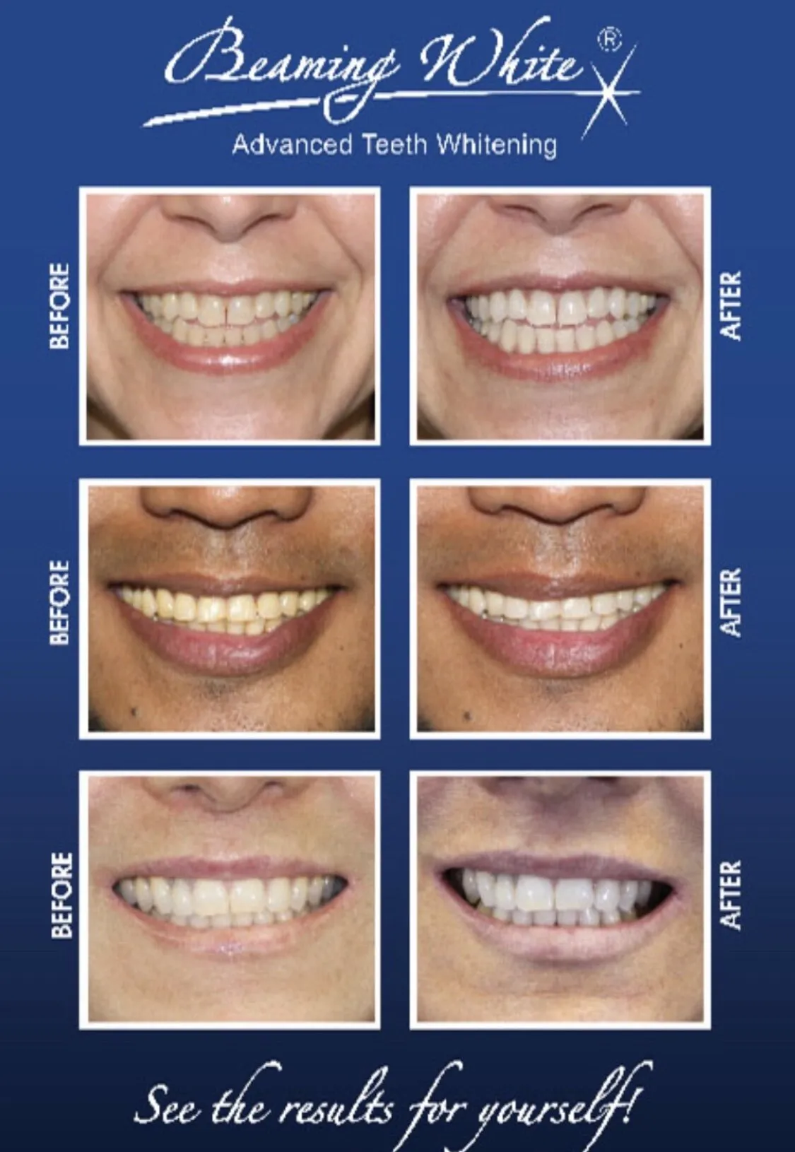 /img/25200-maintaining-white-smile.webp