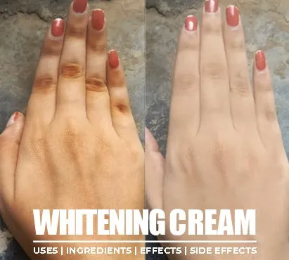 /img/25209-whitening-cream-results.webp