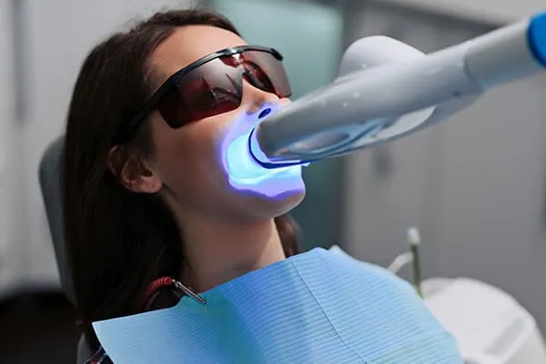 25215 professional teeth whitening