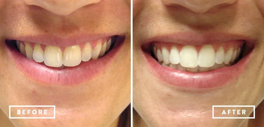 25222 healthy gums