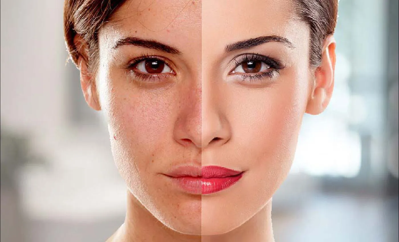 /img/25225-skin-whitening-editor-online-ethical.webp