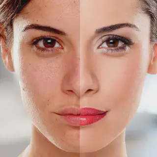 /img/25225-skin-whitening-editor-online-ethical.webp