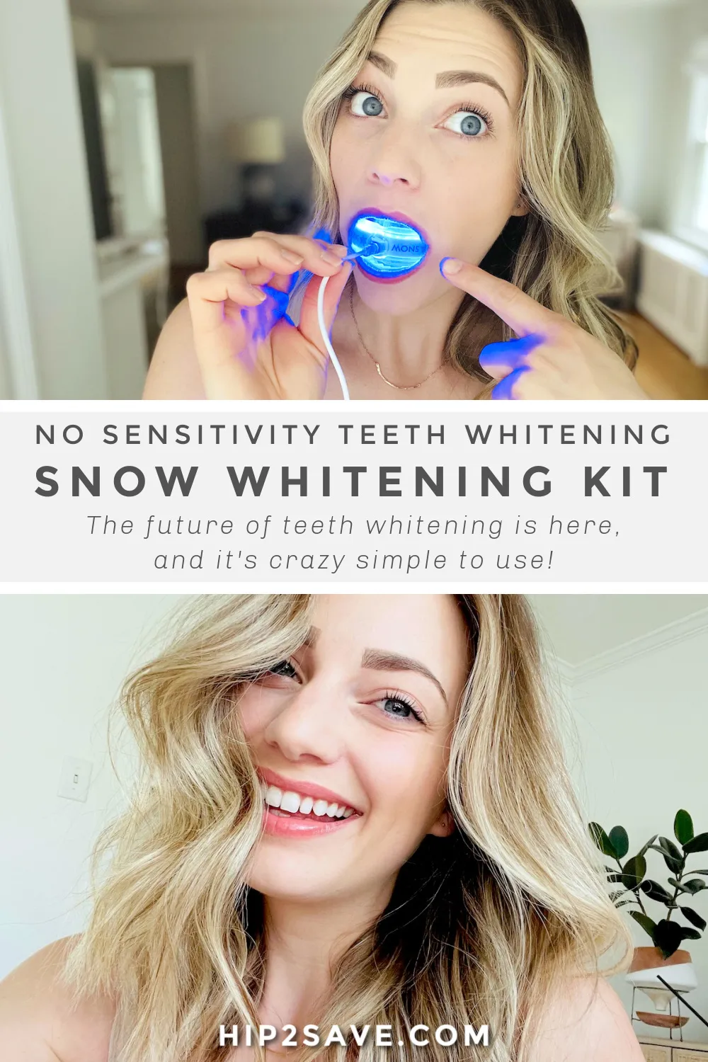 /img/25231-snow-teeth-whitening-results.webp