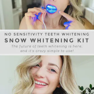 /img/25231-snow-teeth-whitening-results.webp