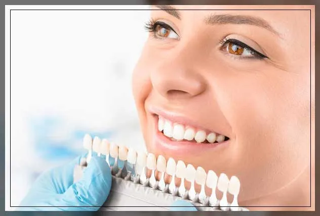 25233 custom whitening trays