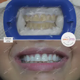 /img/25233-teeth-whitening-clinic-dubai.webp