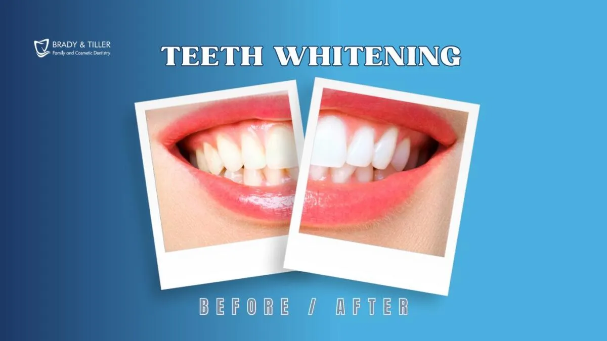 25234 maintain white smile