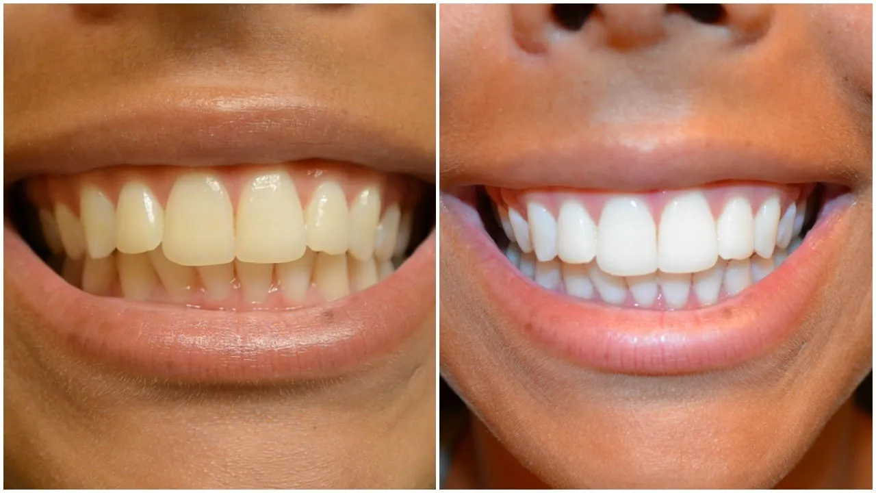 /img/25236-healthy-smile.webp