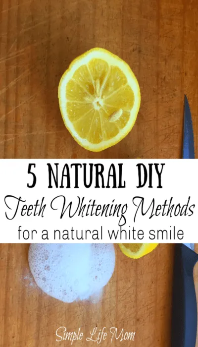 25237 teeth whitening hacks