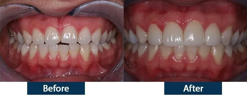 25240 foods drinks staining teeth