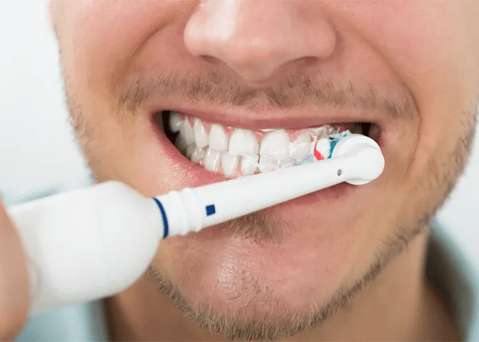 /img/25240-teeth-whitening-aftercare.webp