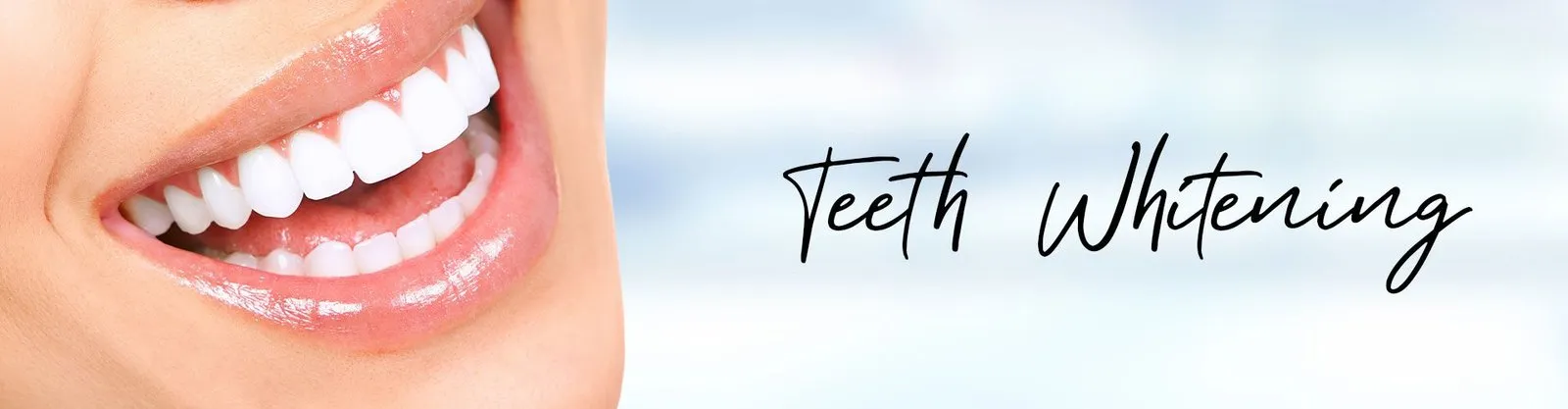 25240 teeth whitening cost lahore
