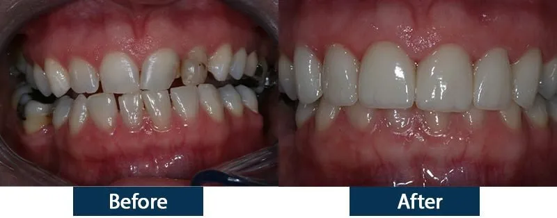 25240 teeth whitening lahore oral hygiene