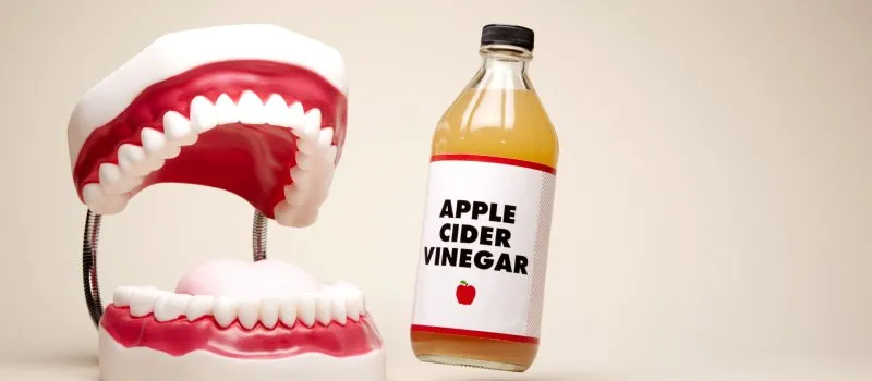 25246 acv teeth whitening 6