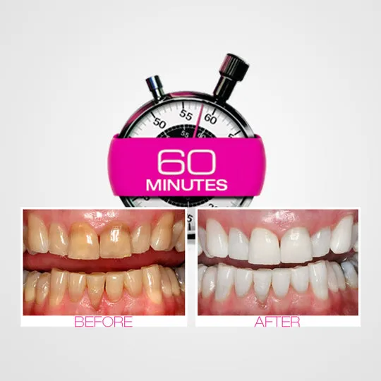 /img/25252-dental-care-routine.webp
