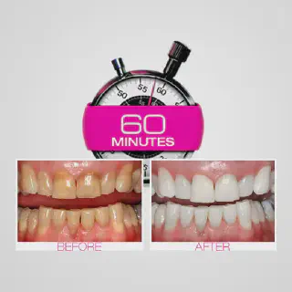 /img/25252-dental-care-routine.webp