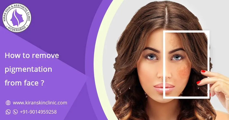 25253 dermatologist consultation hyderabad
