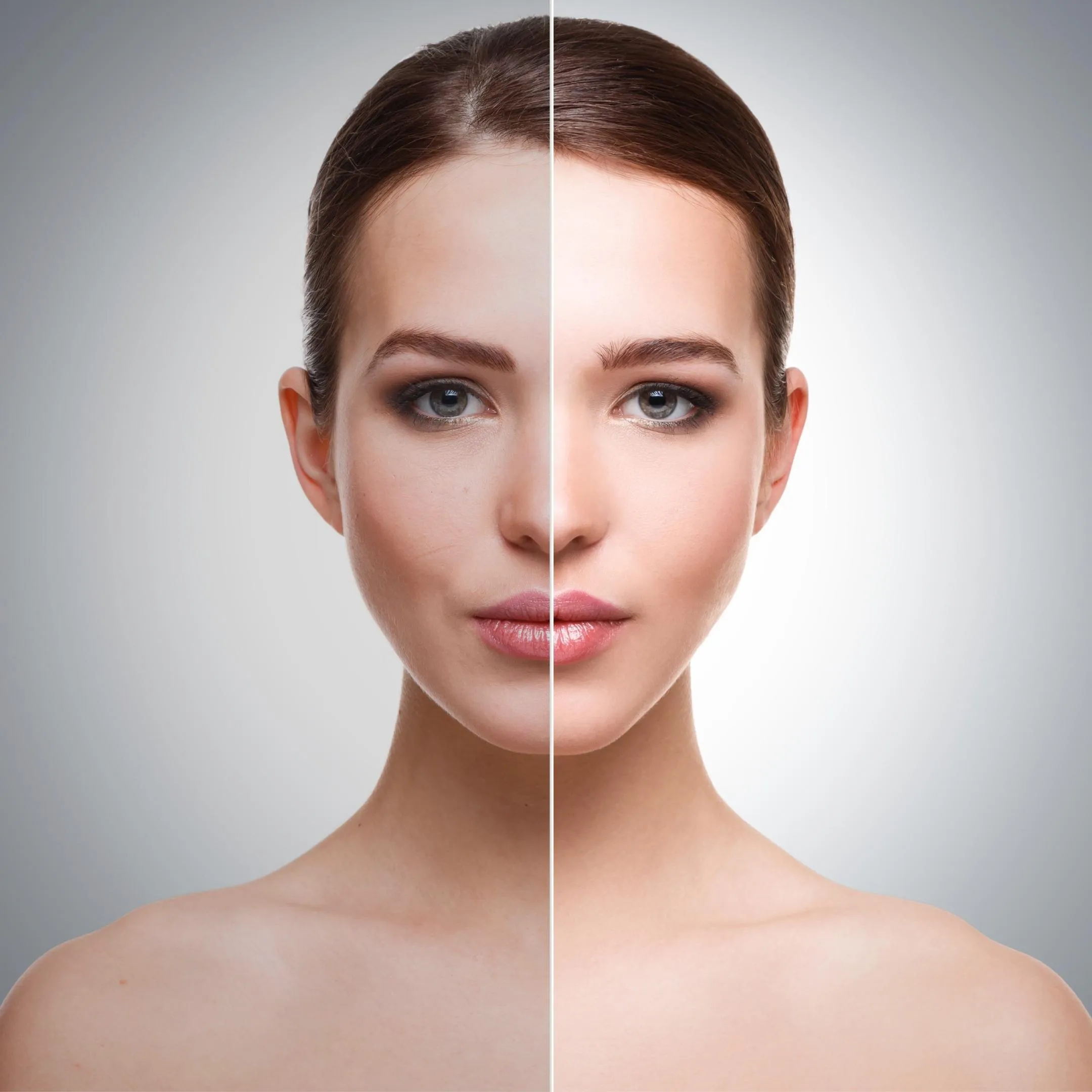 25253 microdermabrasion hyderabad